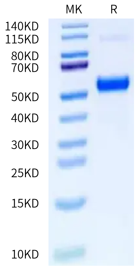 Human Latent PDGFD Protein (PGD-HM101)