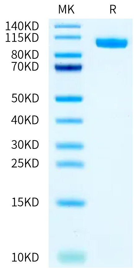 Biotinylated Human PTK7/CCK4 Protein (CCK-HM404B)