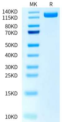 Human PTK7/CCK4 Protein (CCK-HM204)