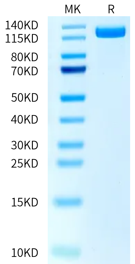Human PTK7/CCK4 Protein (CCK-HM204)
