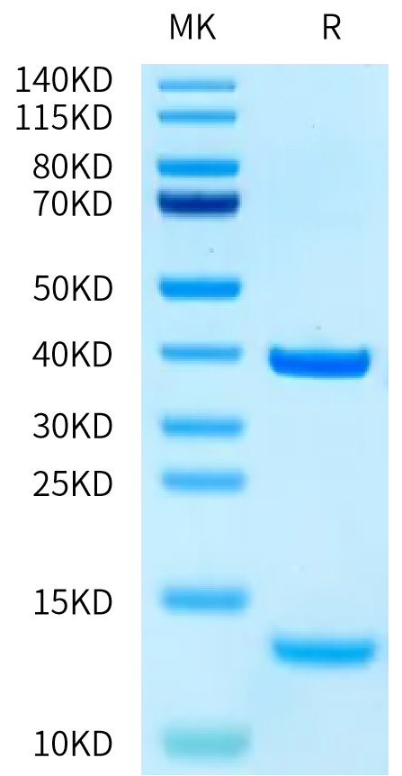 Human HLA-A*03:01&B2M&KRAS WT (VVVGAGGVGK) Monomer Protein (MHC-HE015)