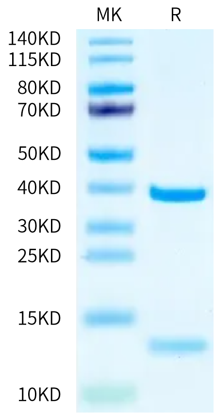 Human HLA-A*03:01&B2M&KRAS G12D (VVVGADGVGK) Monomer Protein (MHC-HE014)