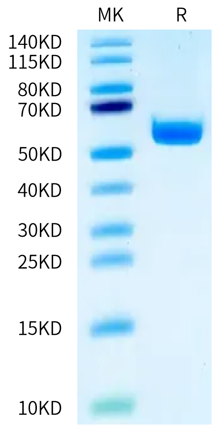 Human HLA-A*11:01&B2M&EGFR L858R (KITDFGRAK) Monomer Protein (MHC-HM4A2)