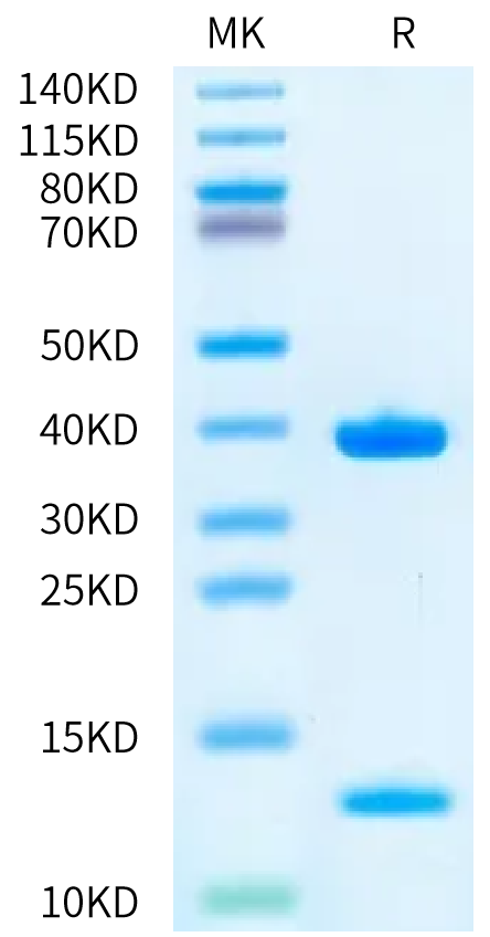 Biotinylated Human HLA-A*03:01&B2M&KRAS WT (VVVGAGGVGK) Monomer Protein (MHC-HE015B)