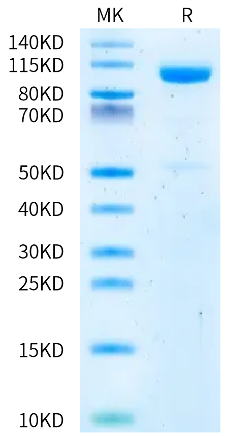 Rat CDH17/Cadherin 17 Protein (CDH-RM127)