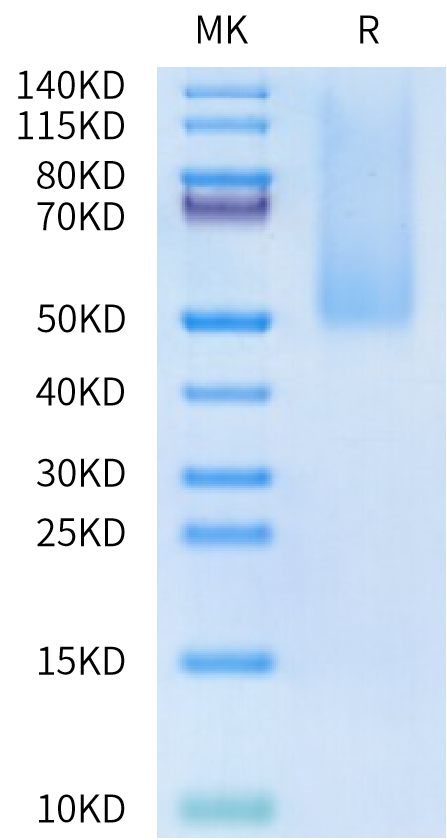 Human CD43 Protein, Ultra Low Endotoxin (CD4-HM143-UL)