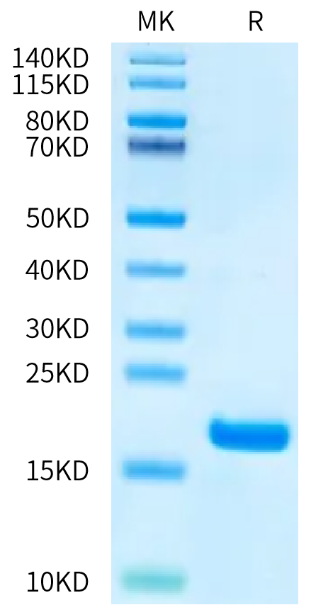 Human FGF1 Protein (FGF-HE00A)