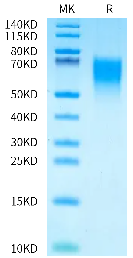 Human MICA*010:01:06 Protein, Ultra Low Endotoxin (MIC-HM102-UL)