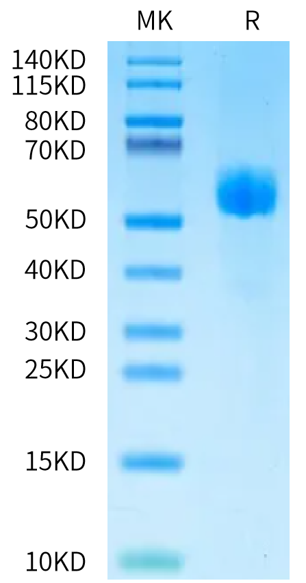 SDS-PAGE gel image showing protein band purity and molecular weight markers for quality validation of recombinant protein.