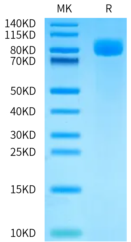 Human Siglec-6/CD327 Protein (SIG-HM206)