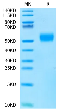 SDS-PAGE gel showing a clear single band in the sample lane, indicating high purity of the protein. Molecular weight marker is visible on the left.