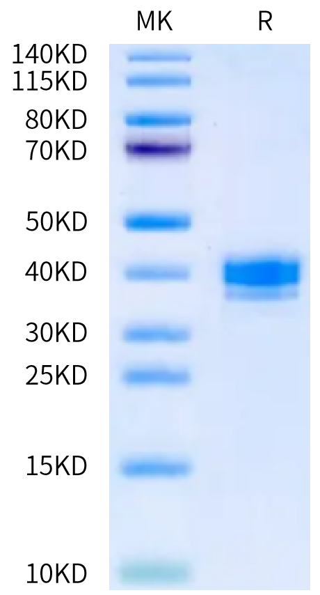 Mouse APLN Protein (APN-MM201)