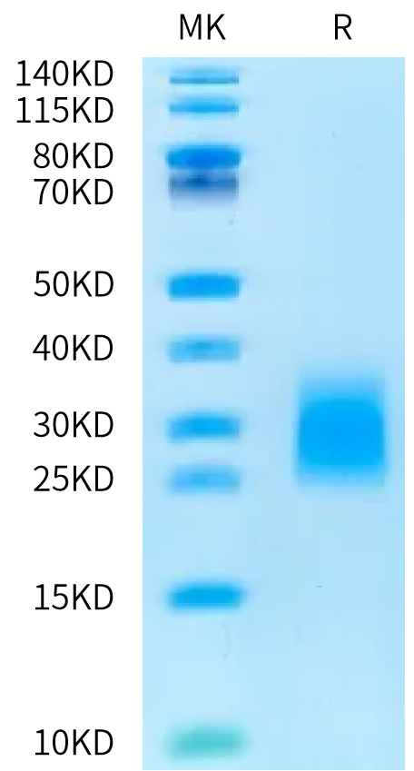 Human LSR Protein, Ultra Low Endotoxin (LSR-HM101-UL)
