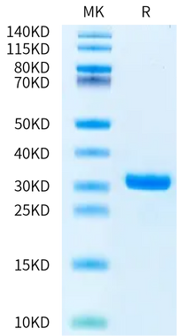 Human Kallikrein 7/KLK7 Protein (pro form) (KLK-HM117)