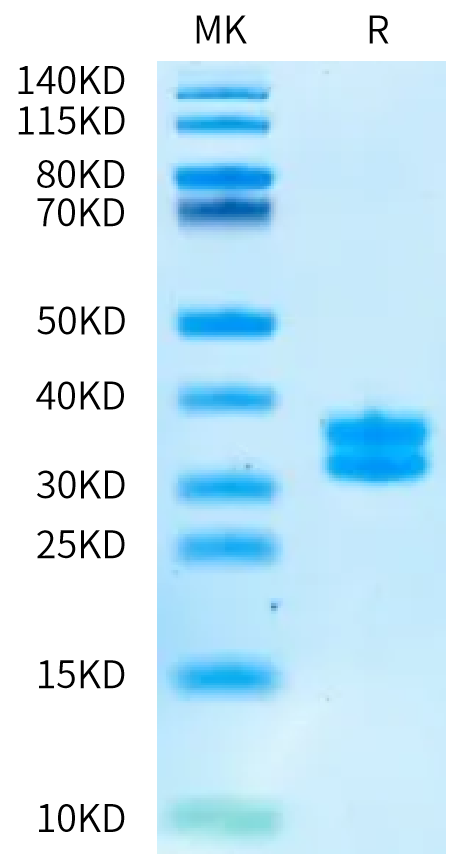 Biotinylated Human Kallikrein 7/KLK7 Protein (pro form) (KLK-HM417B)