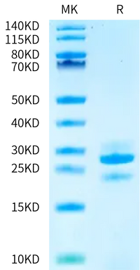 Human Kallikrein 7/KLK7 Protein (active form) (KLK-HM007)