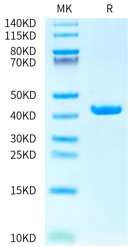 Human SEZ6 Sushi4 Domain Protein, Ultra Low Endotoxin (SEZ-HM20D-UL)