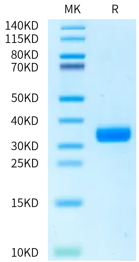 Rat ANGPT2/Angiopoietin-2 Protein (APN-RM102)