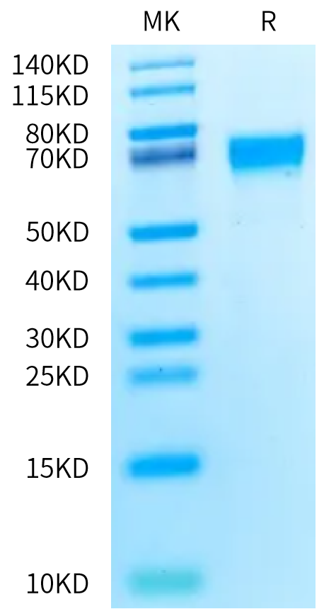 Rat AXL Protein (AXL-RM101)