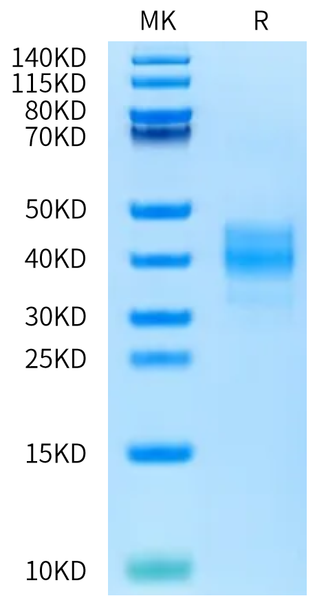 Rat ASGR1 Protein (ASG-RM1R1)