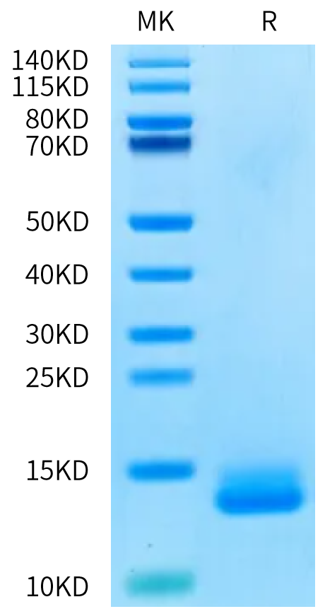 Human ITPRIPL1/CD3L1 Protein (CD3-HM1L1)