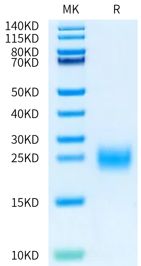 Human BAFF/TNFSF13B/CD257 (68-133) Protein (BAF-HM13D)