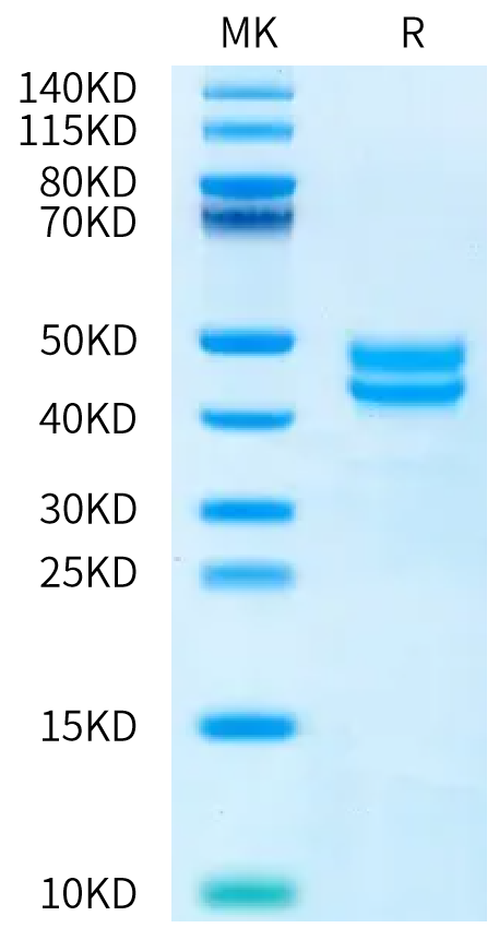 Human BAFF/TNFSF13B/CD257 (68-133) Protein, Ultra Low Endotoxin (BAF-HM23D-UL)