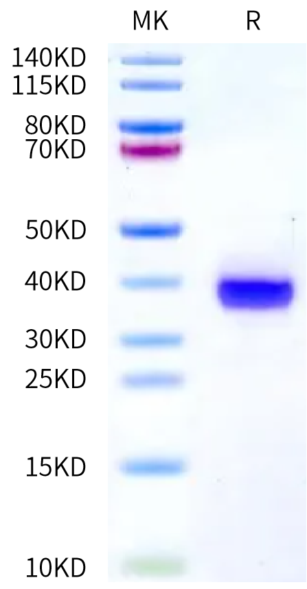 Human Siglec-2/CD22 Domain 6&7 Protein, Ultra Low Endotoxin (SIG-HM123-UL)