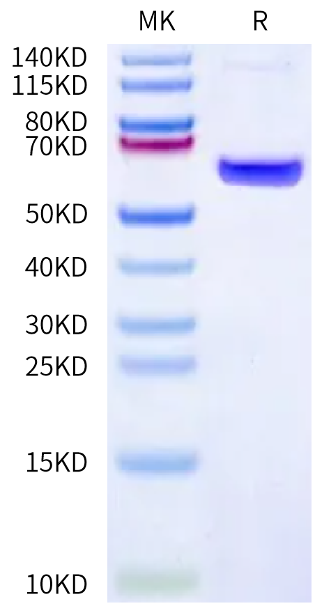 Human CA4/Carbonic Anhydrase IV Protein, Ultra Low Endotoxin (CA4-HM204-UL)