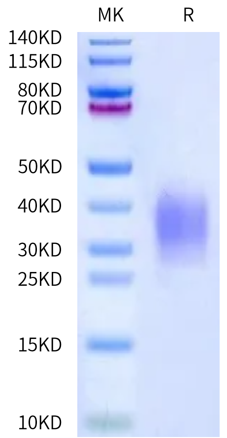 Biotinylated Mouse uPAR/PLAUR Domain 3 Protein, Ultra Low Endotoxin (PAR-MM1D3B-UL)