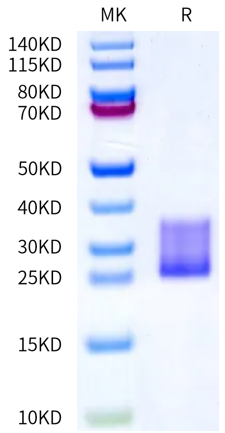 Mouse IL-6 Protein (IL6-MM106)