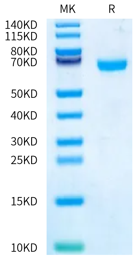 Human CA12/Carbonic anhydrase XII Protein, Ultra Low Endotoxin (CAS-HM212-UL)