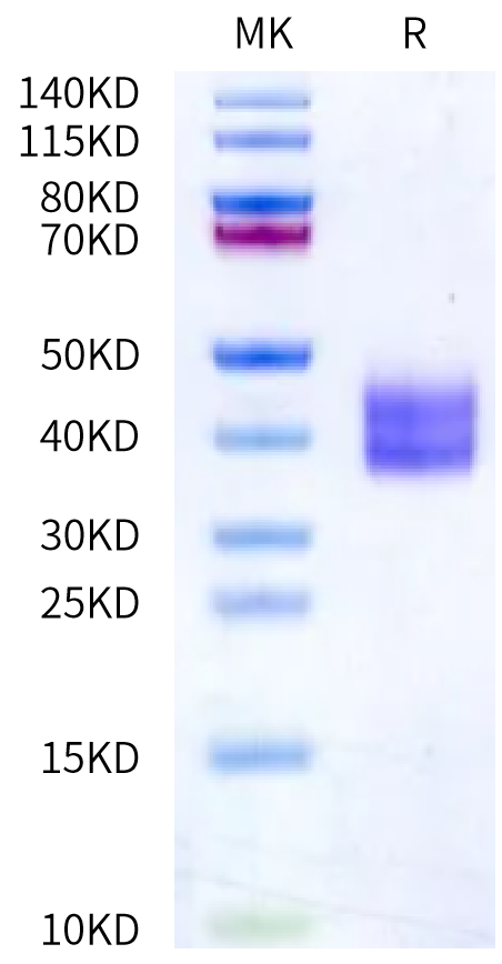 Human Kallikrein 1/KLK1 Protein (active form) (KLK-HM101)