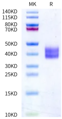 Human Kallikrein 1/KLK1 Protein (active form) (KLK-HM101)