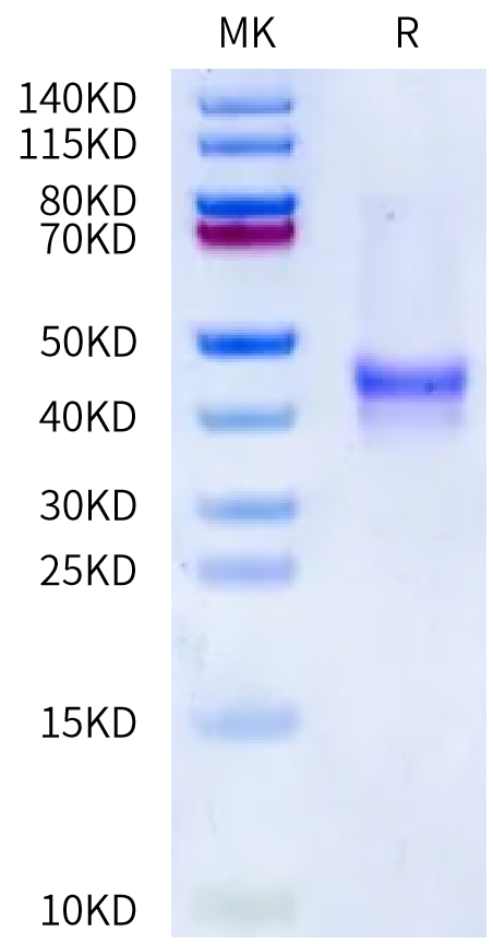 Human Mucin-1/MUC-1 Protein (MUC-HM101)
