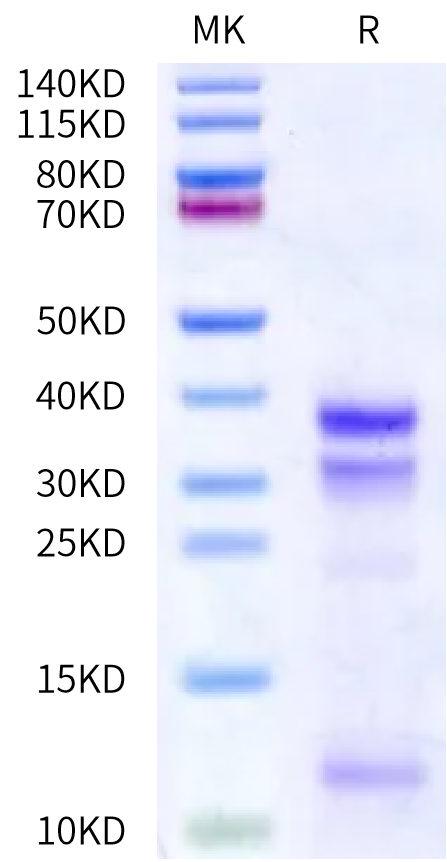 Mouse Kallikrein 7/KLK7 Protein (active form) (KLK-MM107)