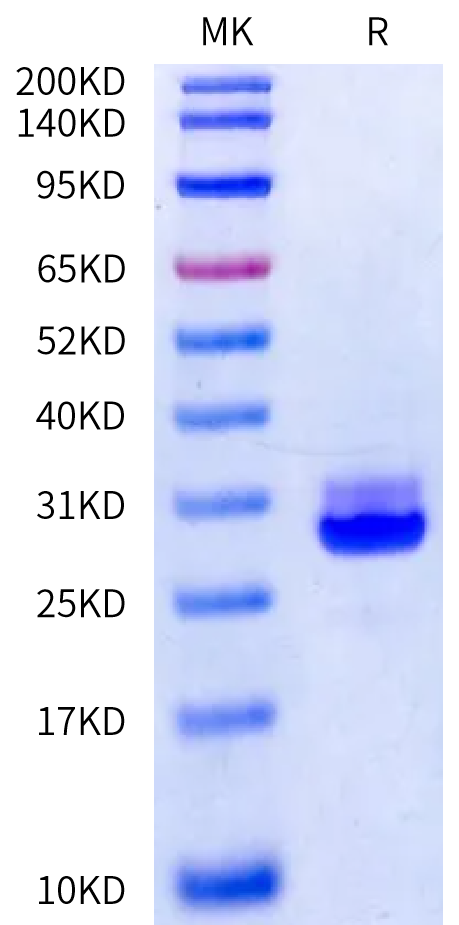 Cynomolgus Kallikrein 7/KLK7 Protein (active form) (KLK-CM107)