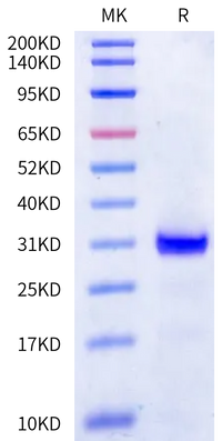 Human Kallikrein 2/KLK2 Protein (active form) (KLK-HM002)