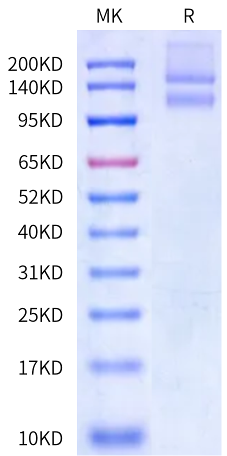 Biotinylated Human Integrin alpha 2 beta 1 (ITGA2&ITGB1) Heterodimer Protein (ITG-HM4ABB)