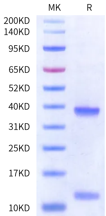 Human HLA-A*02:01&B2M&CG1 (FLLPTGAEA) Monomer Protein (MHC-HE452)