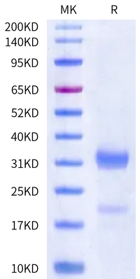 Human Kallikrein 2/KLK2 Protein (active form) (KLK-HM102)