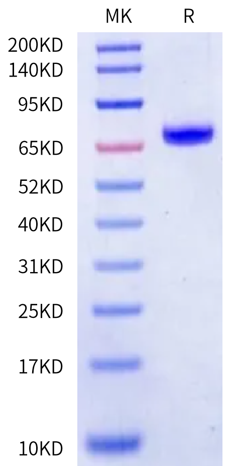 Human CA14/Carbonic Anhydrase XIV Protein (CA4-HM214)