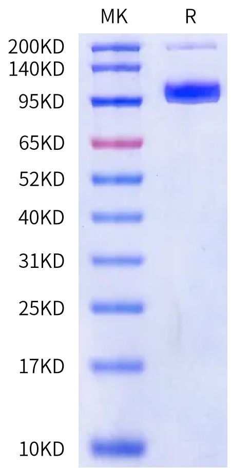 Rat PSMA/FOLH1 Protein (active dimer), Ultra Low Endotoxin (PSM-RM110-UL)