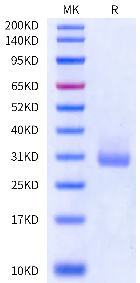 Human Kallikrein 4/KLK4 Protein (active form), Ultra Low Endotoxin (KLK-HM104-UL)