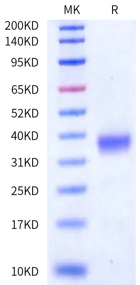 Human Kallikrein 8/KLK8 Protein (active form) (KLK-HM108)
