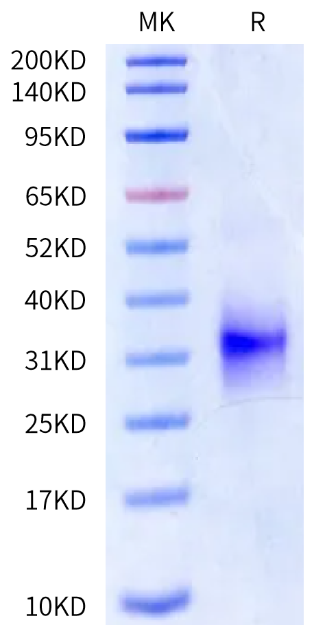 Cynomolgus IL-25/IL-17E Protein (IL2-CM125)