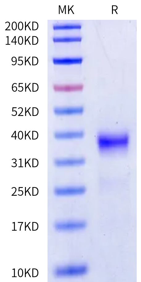 Human Kallikrein 13/KLK13 Protein (active form) (KLK-HM113)