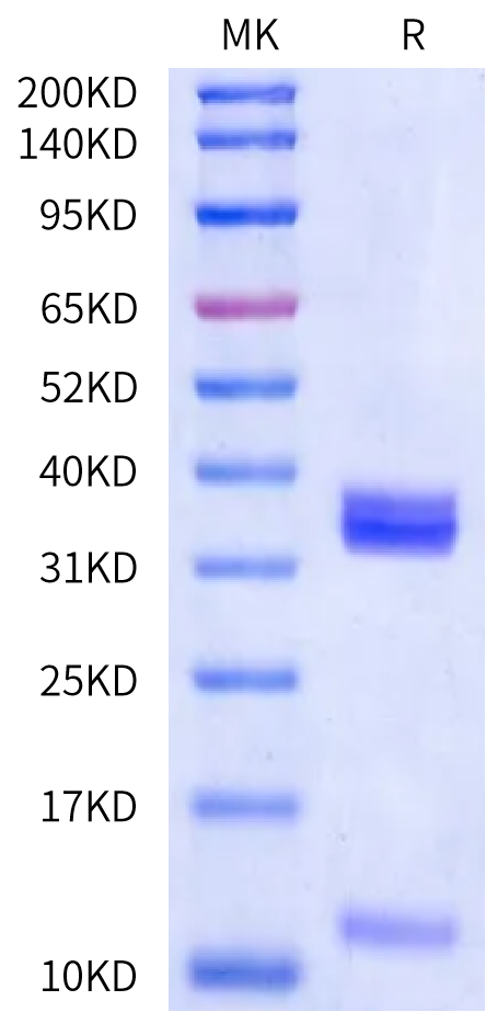 Human HLA-A*02:01&B2M&HBV (FLLTRILTI) Monomer Protein (MHC-HE457)