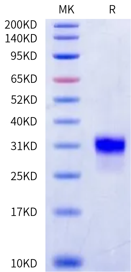 Human Kallikrein 6/KLK6 Protein (pro form) (KLK-HM116)