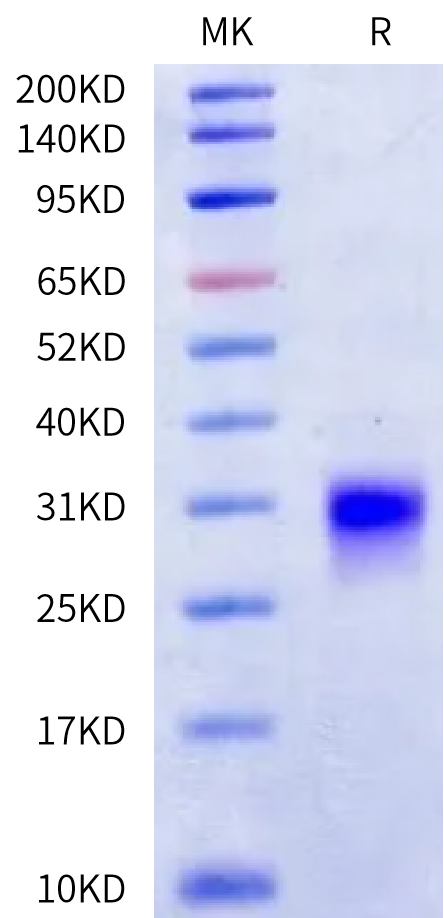 Human Kallikrein 6/KLK6 Protein (active form) (KLK-HM106)